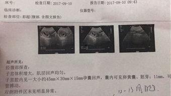 怀孕51天了,初孕体验与身体变化揭秘